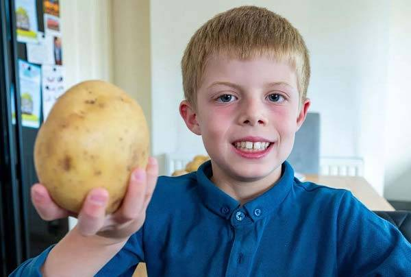제목: “밥 거부, 7년째 감자만 2500개 먹어…” 영국 여덟살 소년, 알고 보니 ‘이 병’?